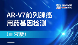 前列腺癌靶向治疗耐药的预警“神器”——AR-V7基因检测